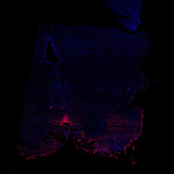 11PCW human midbrain